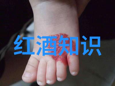斯芬克斯